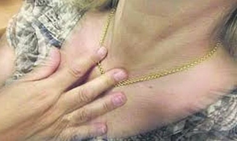 Πύργoς: Συνελήφθη ο… αγκαλίτσας!