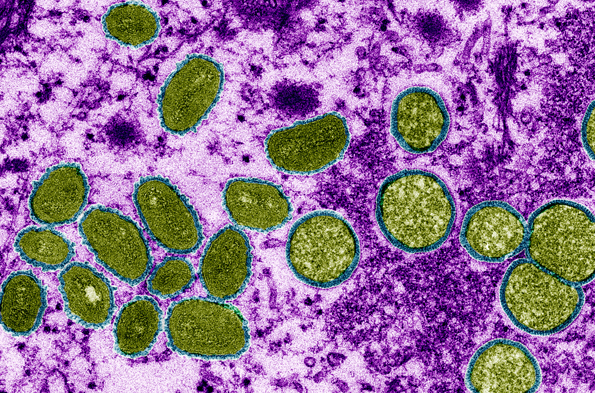 Mpox: Γιατί ο ΠΟΥ κήρυξε για δεύτερη φορά πανδημία – Ποιοι μπορούν να εμβολιαστούν στην Ελλάδα